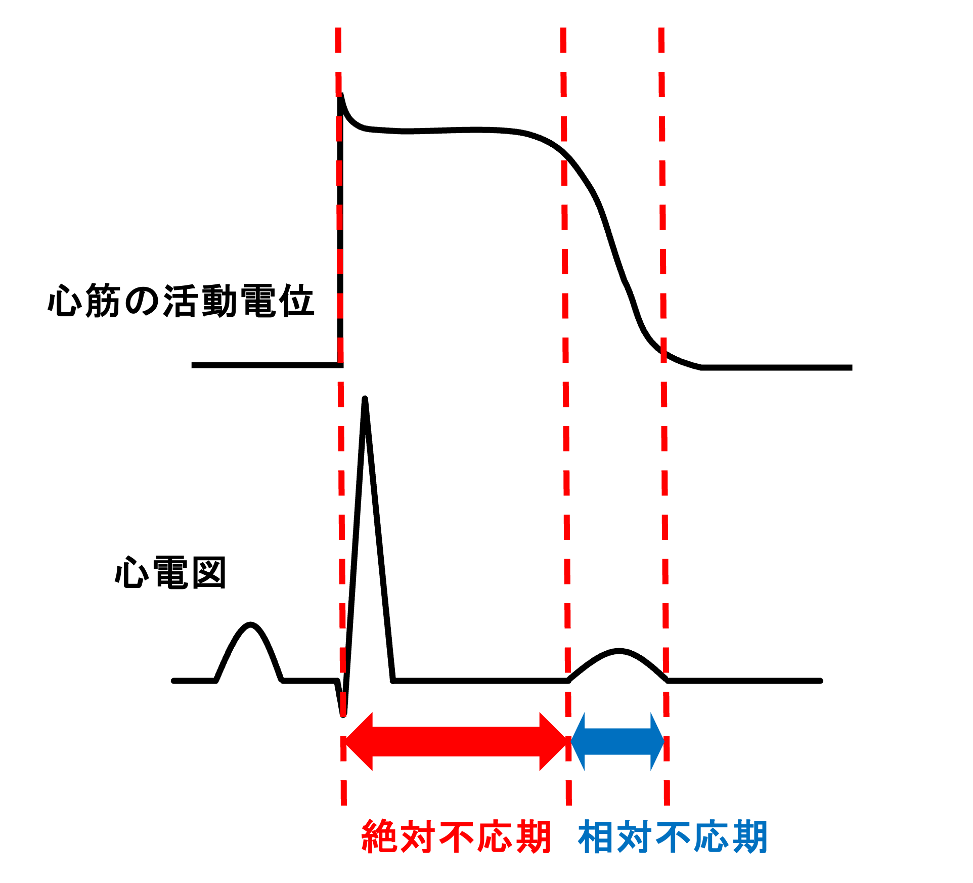 不応期(refractory period)