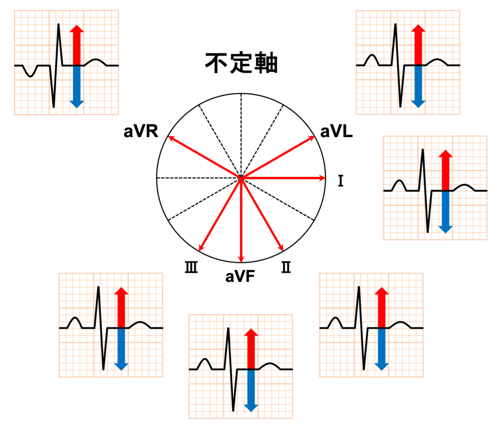 不定軸(indeterminate axis)