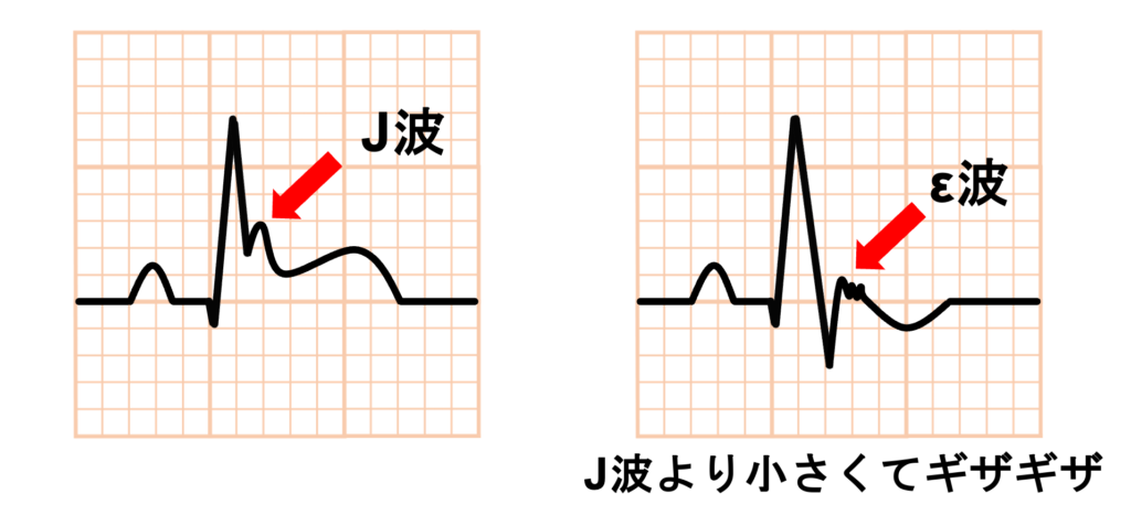 ε波(εwave)