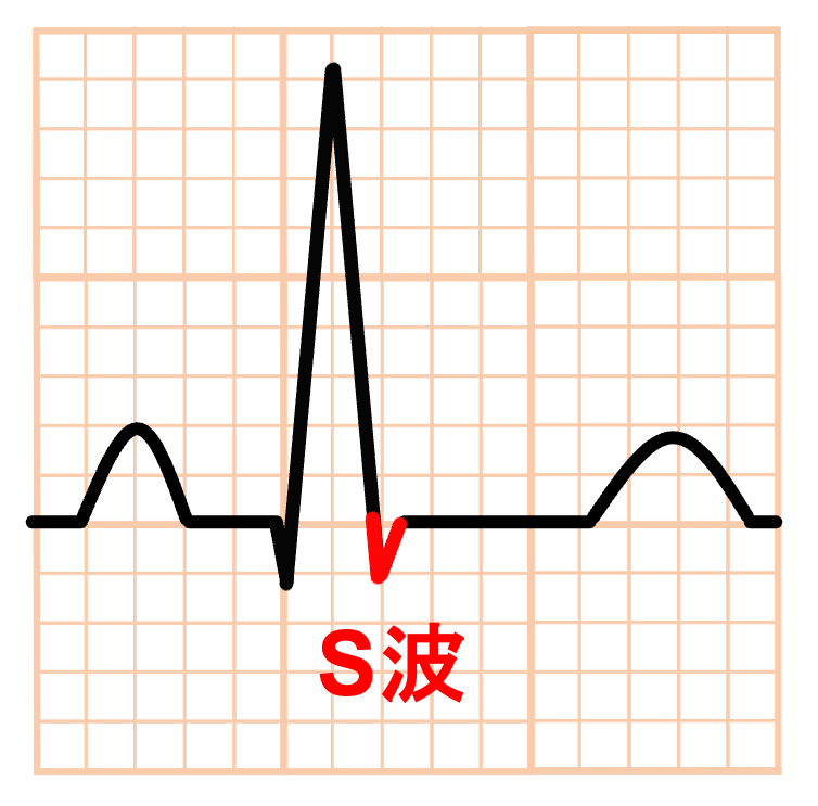 S波(S wave)