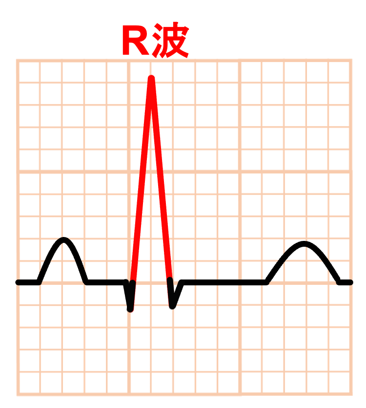 R波(R wave)