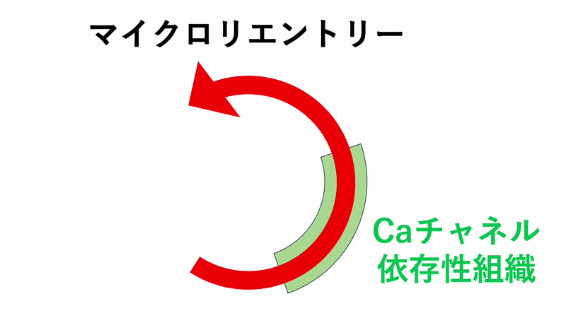 ATP感受性心房頻拍(ATP-sensitive atrial tachycardia)