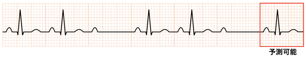 心房細動(Atrial fibrillation)