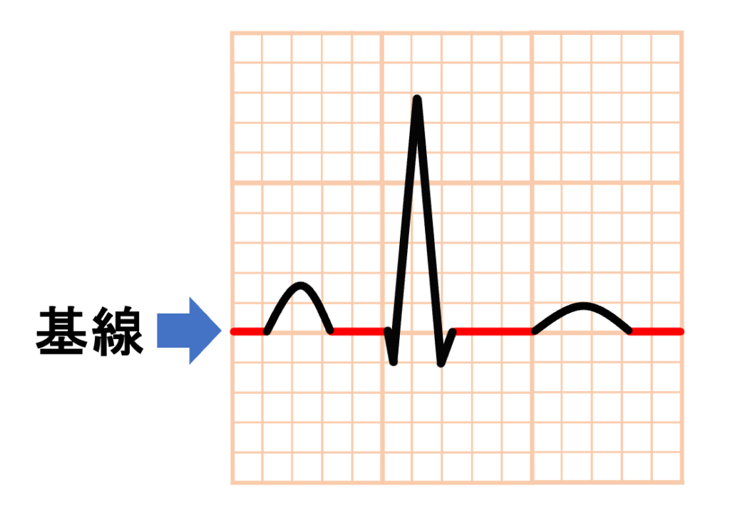 基線(baseline)、等電位線(isoelectric line)