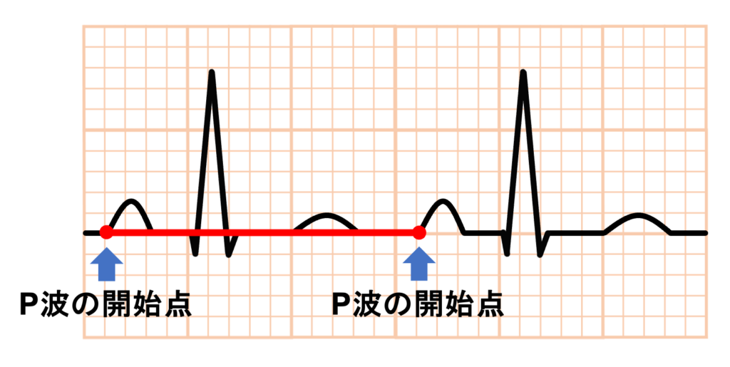 基線(baseline)、等電位線(isoelectric line)