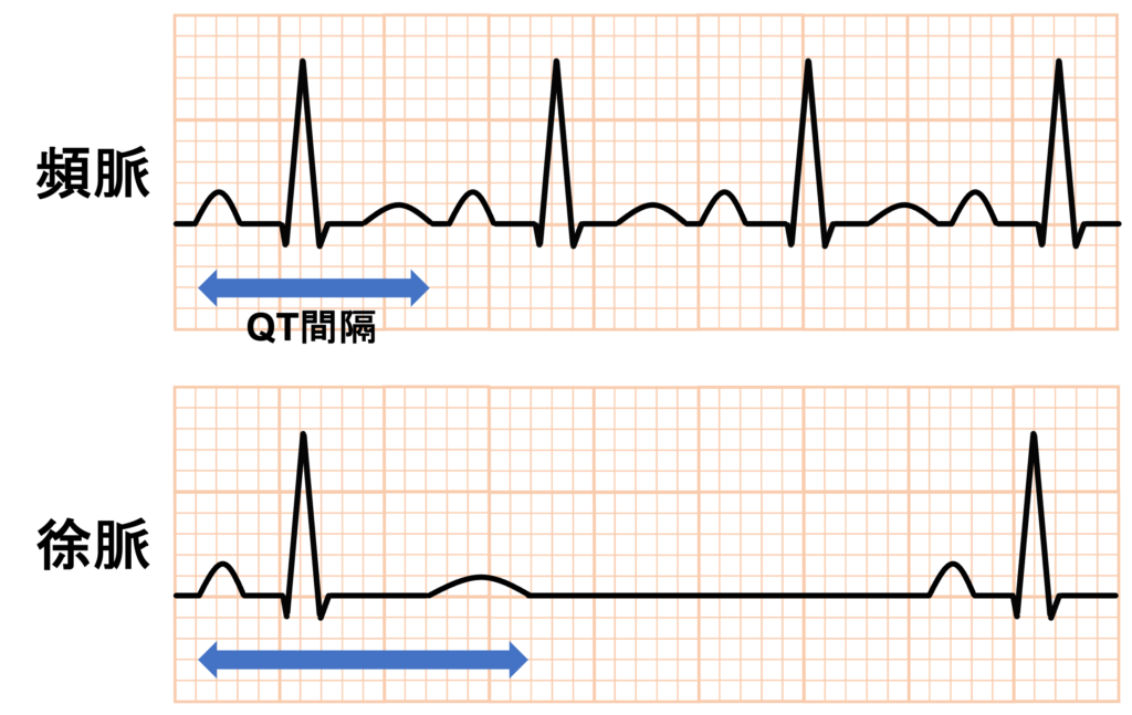 QTc(corrected QT)