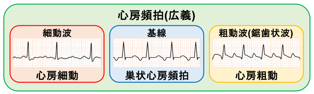 心房頻拍(atrial tachycardia)