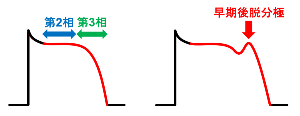 早期後脱分極(early afterdepolarization)