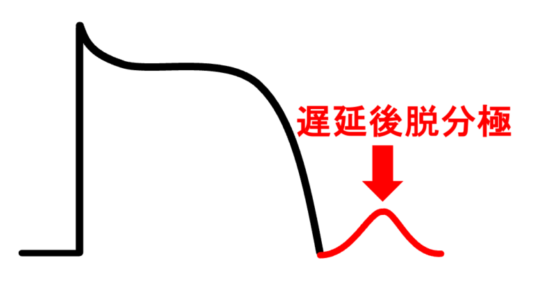早期後脱分極とは? | 心電図.com