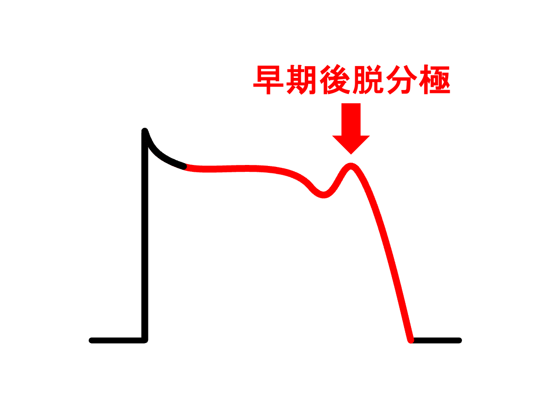 早期後脱分極(early afterdepolarization：EAD)