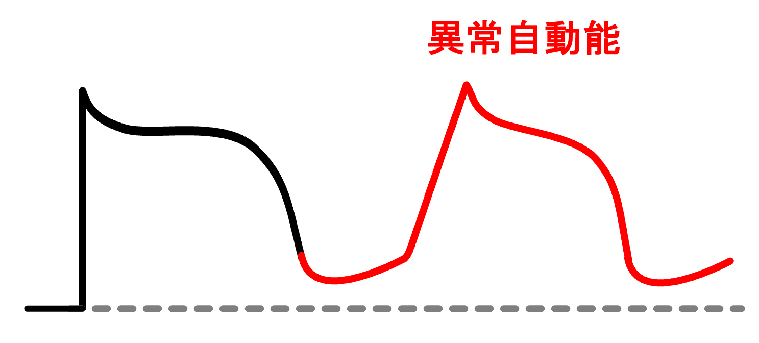 異常自動能(abnormal automaticity)