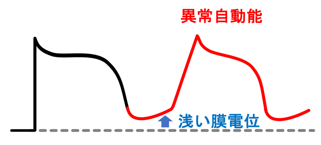 異常自動能(abnormal automaticity)