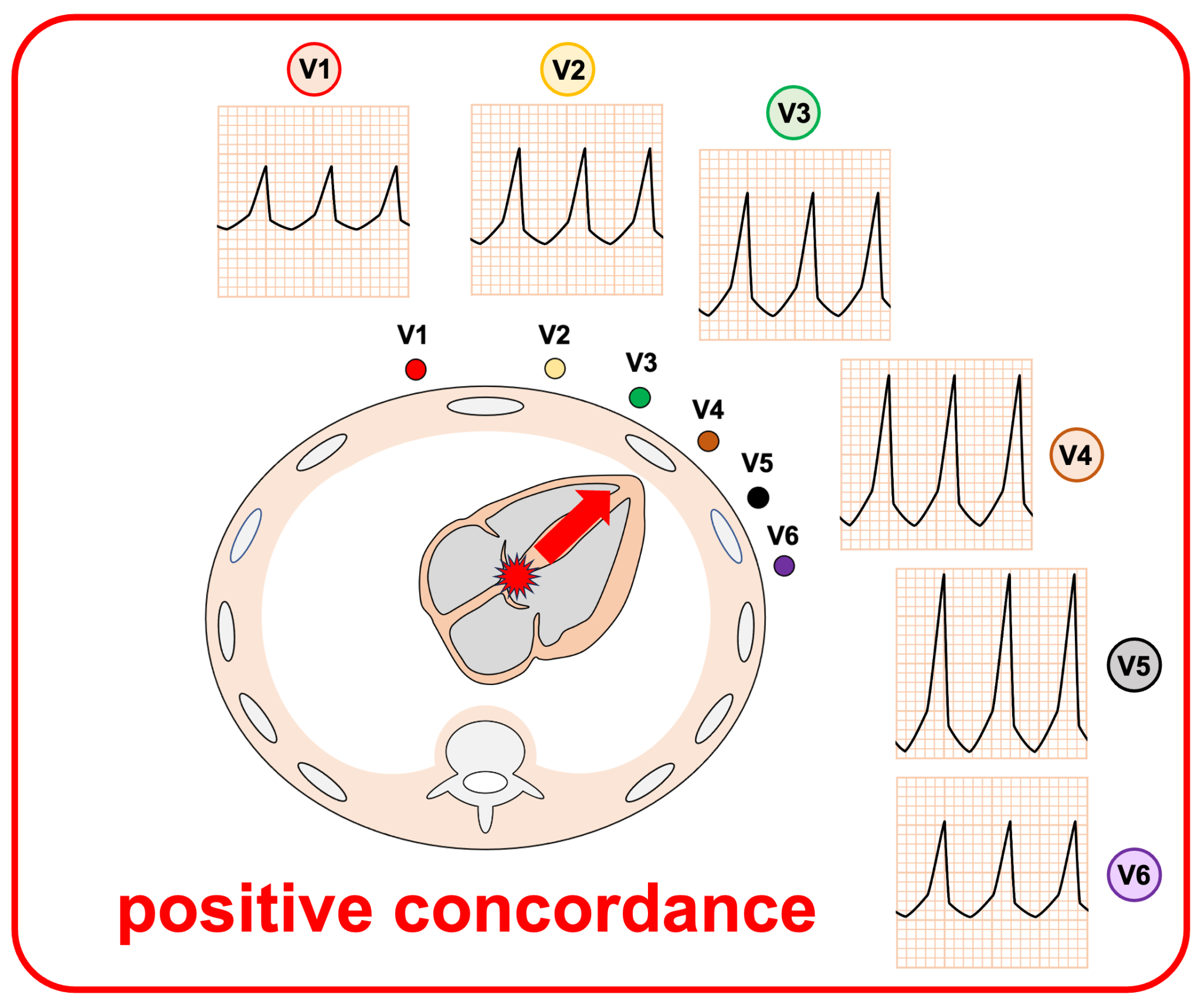 concordanceとは？