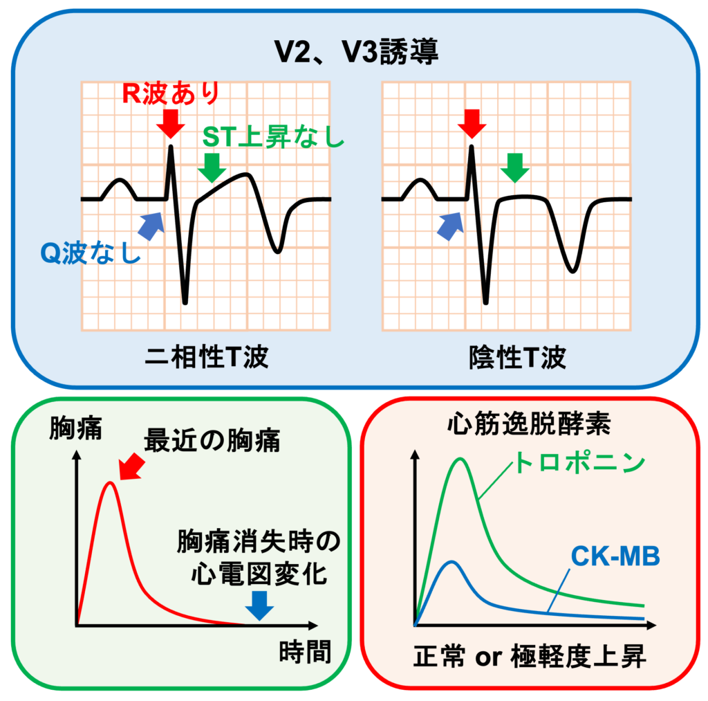 Wellens症候群(Wellens syndrome)