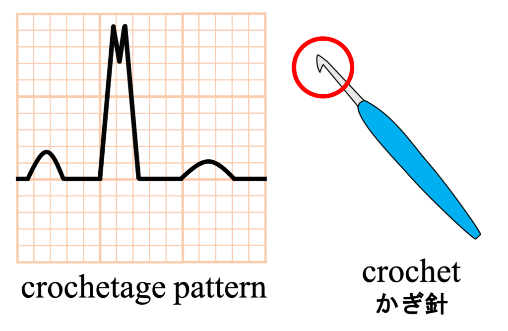 心房中隔欠損症(atrial septal defect : ASD)