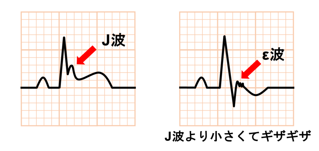 ε波(εwave)