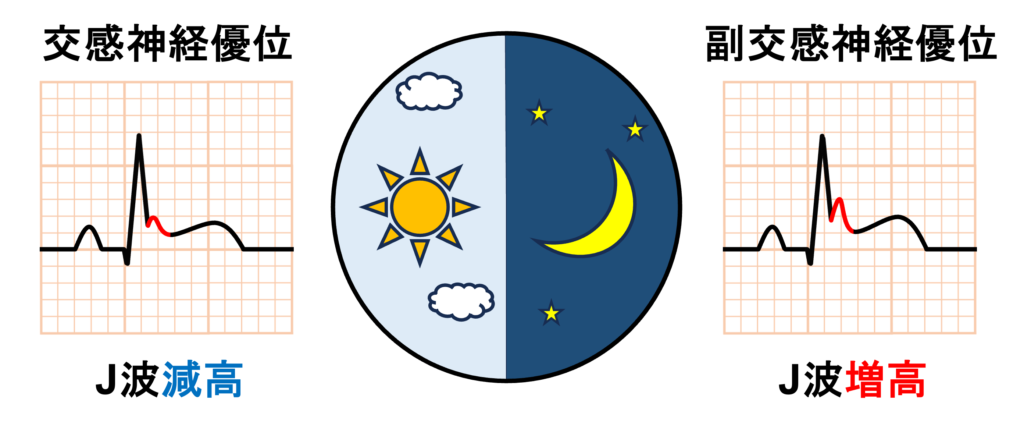 J波(J wave)