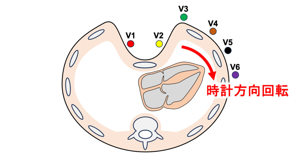 漏斗胸(pectus excavatum)