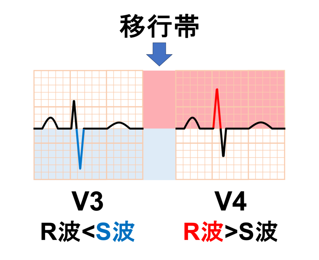 移行帯(transitional zone)