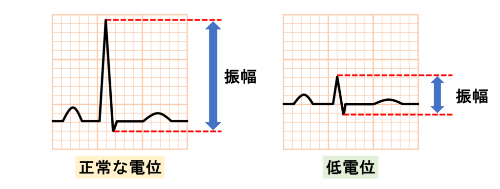 低電位(Low voltage)