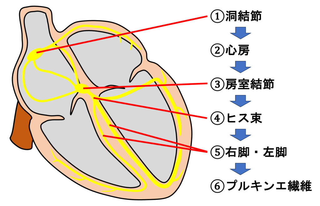 右脚ブロック(right bundle branch block：RBBB)