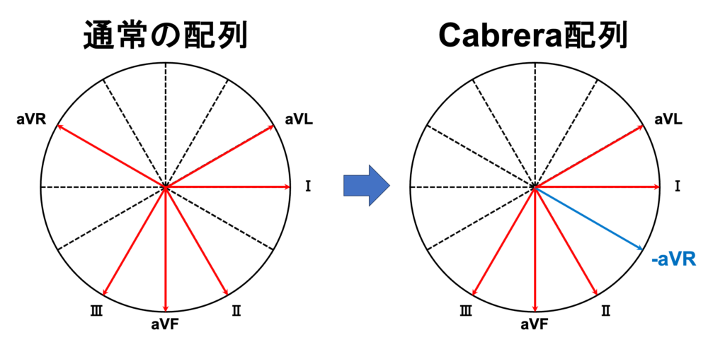 カブレラ配列(Cabrera sequence)