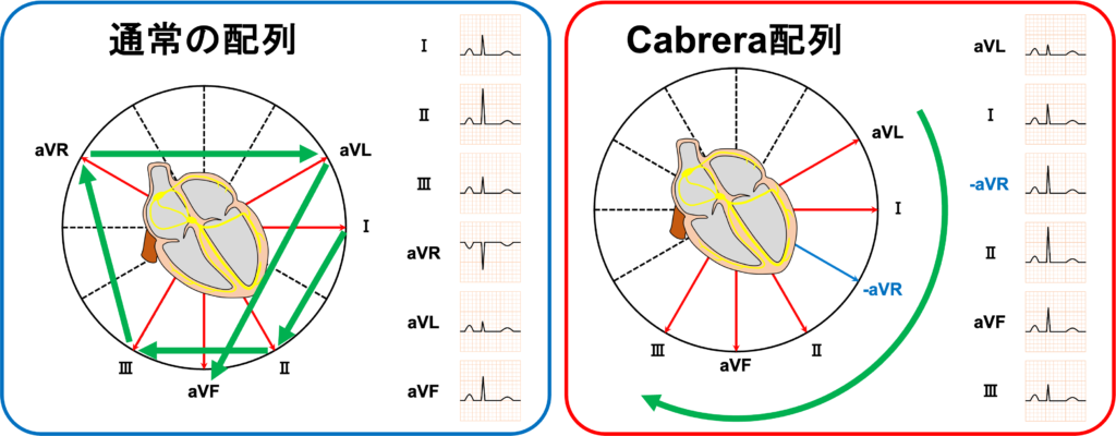 カブレラ配列(Cabrera sequence, Cabrera system)