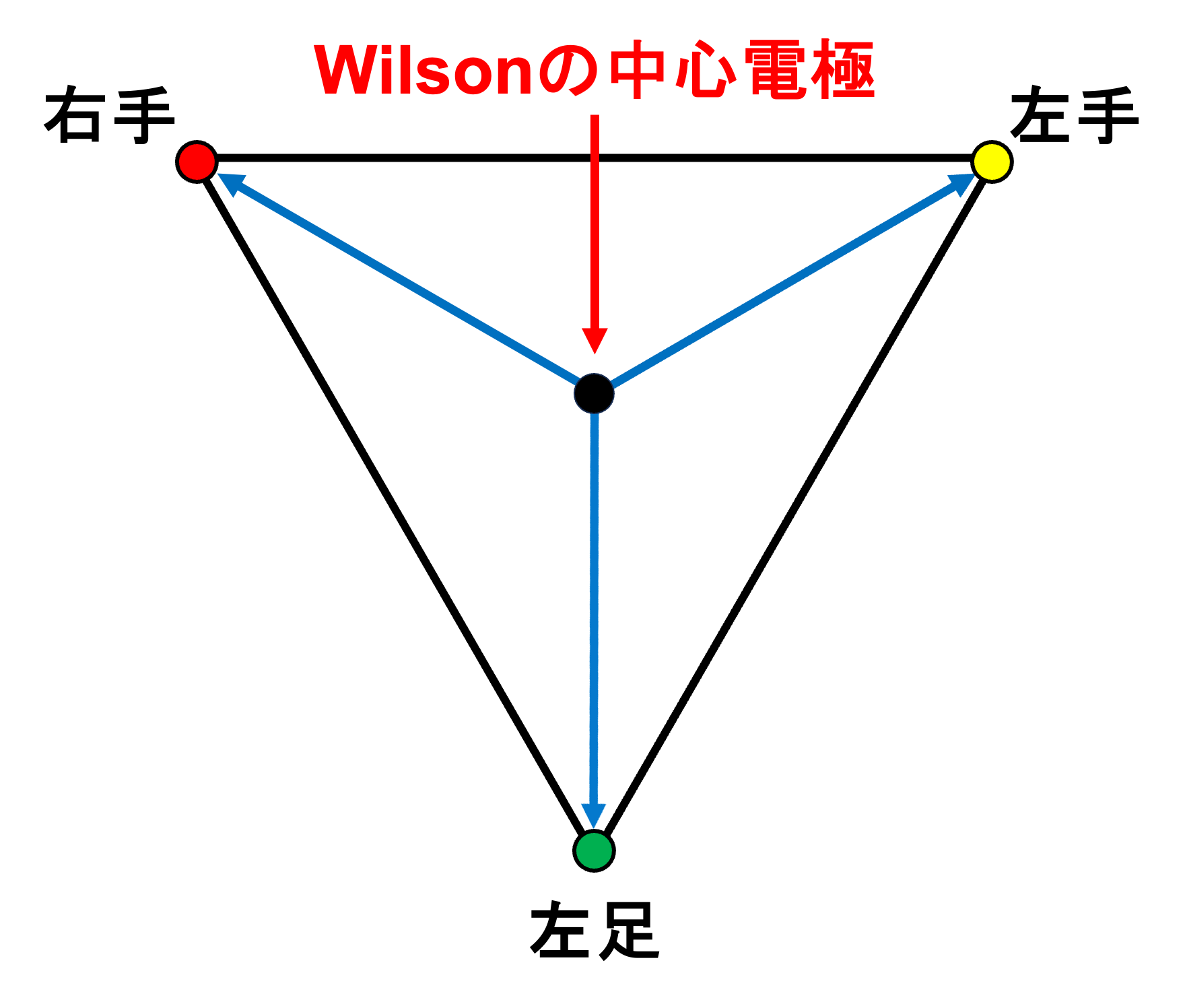 Wilsonの中心電極(Wilson's central terminal)