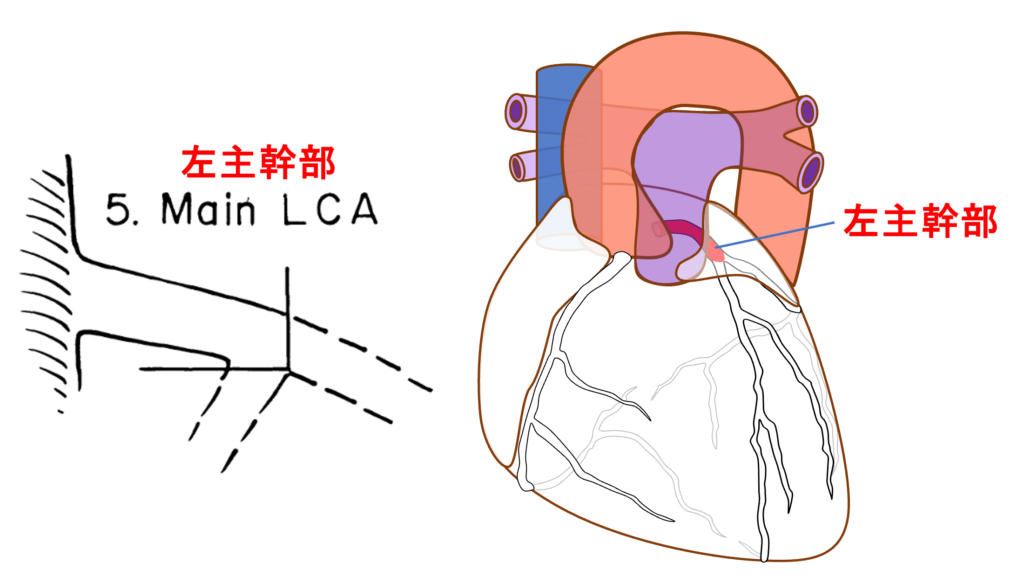 冠動脈分類