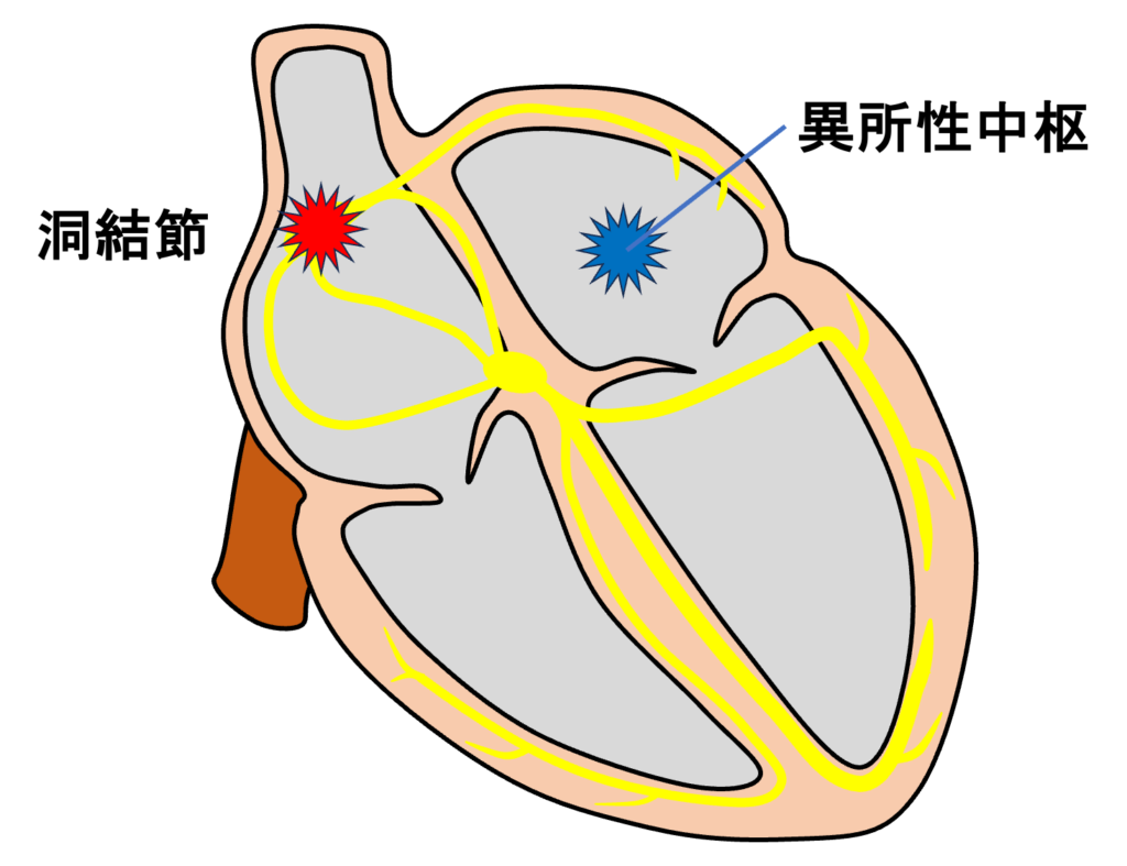 心房副収縮(atrial parasystole)