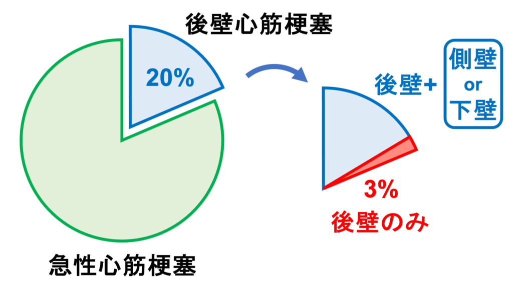 後壁心筋梗塞(posterior myocardial infarction)