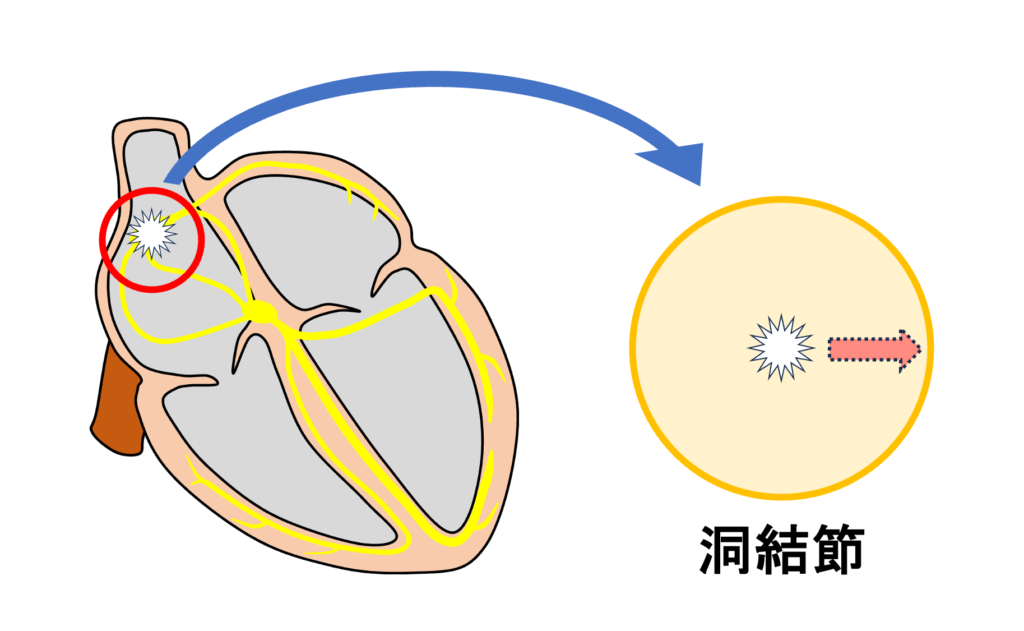 洞停止(sinus arrest)