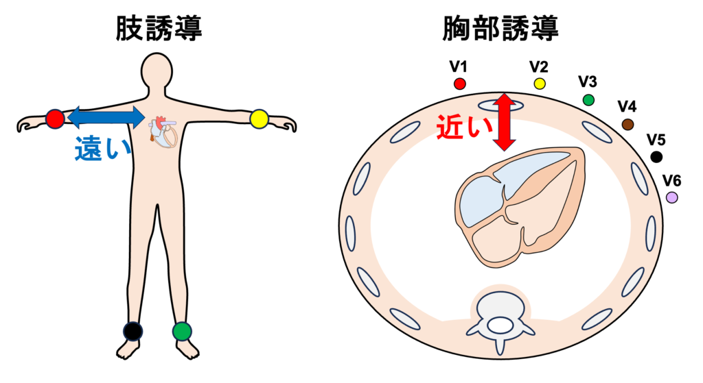 低電位(Low voltage)