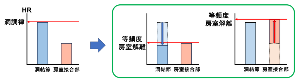 等頻度房室解離(isorhythmic atrioventricular dissociation)