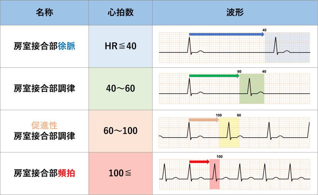 房室接合部調律(Junctional rhythm)