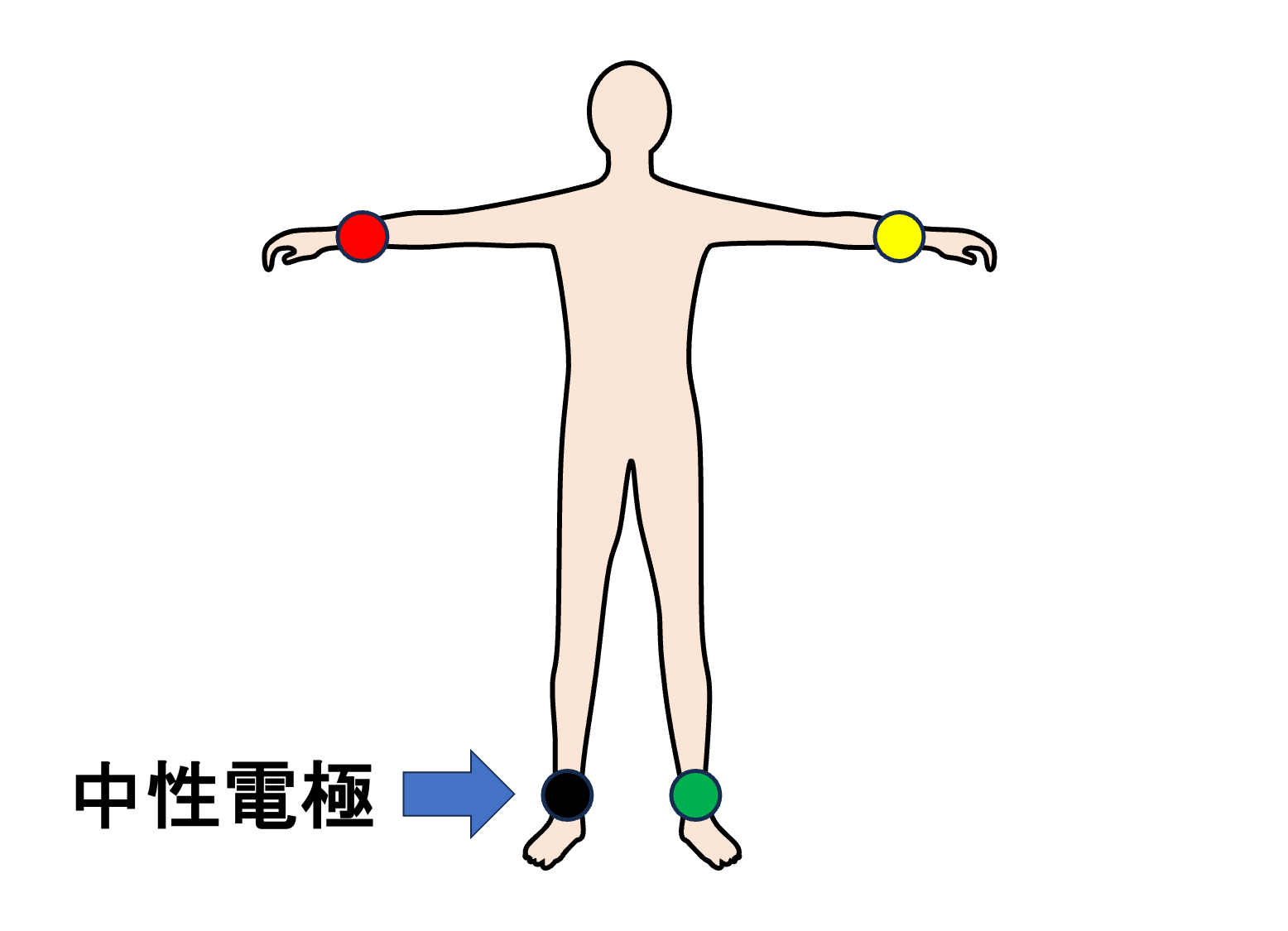 中性電極(neutral electrode)