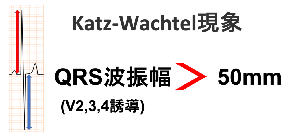 Katz-Wachtel現象(Katz-Wachtel phenomenon)