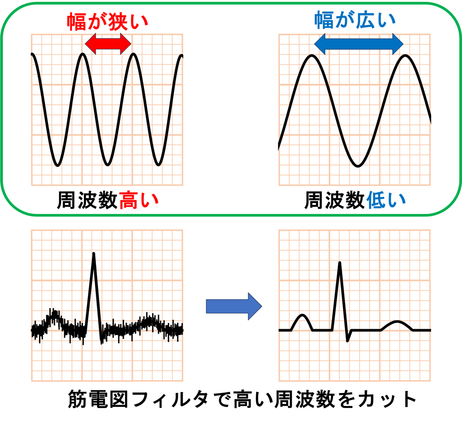 筋電図とは？ | 心電図.com