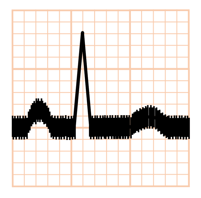 交流障害(powerline interference, hum)