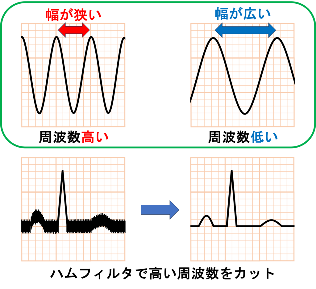 交流障害(powerline interference, hum)