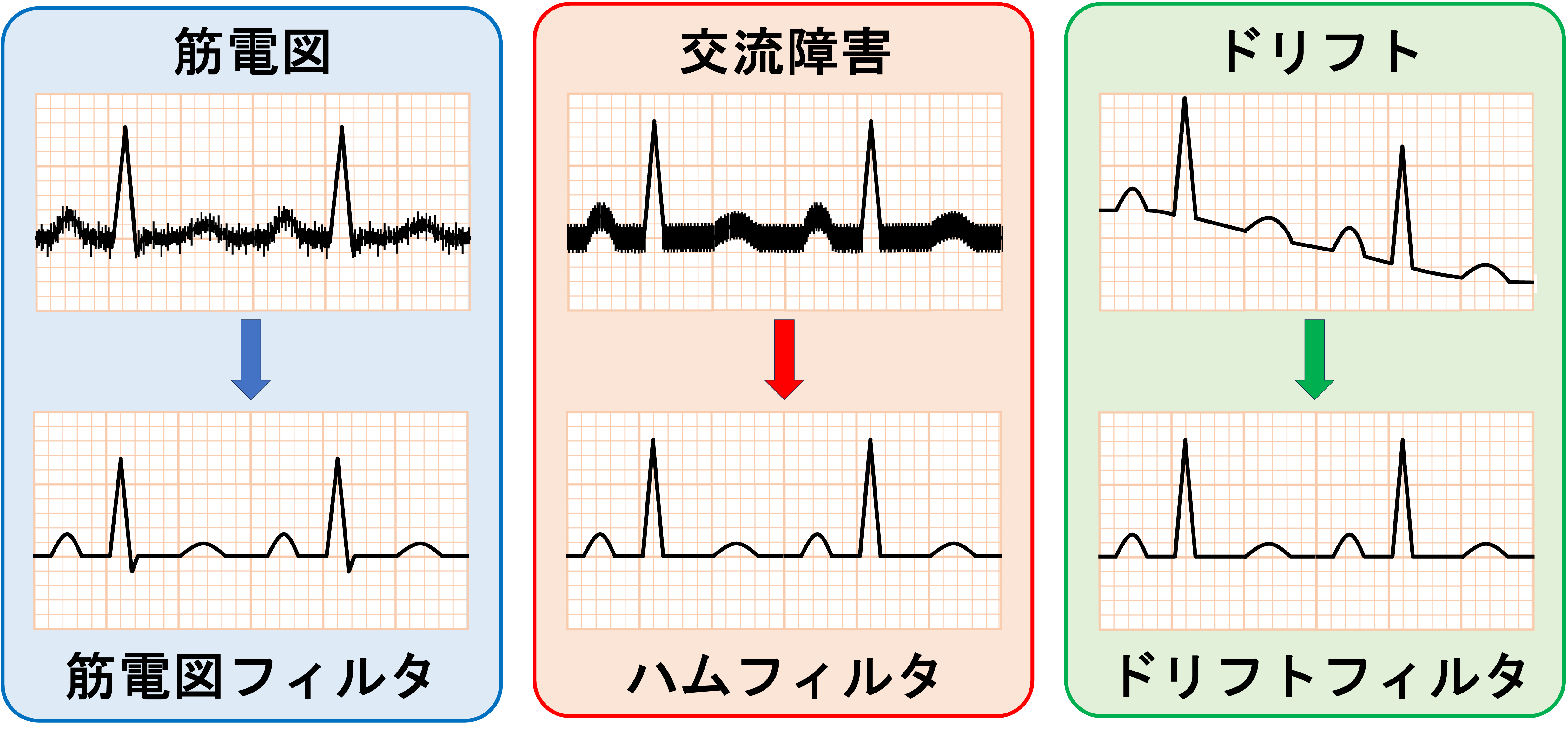 フィルタ(filter)