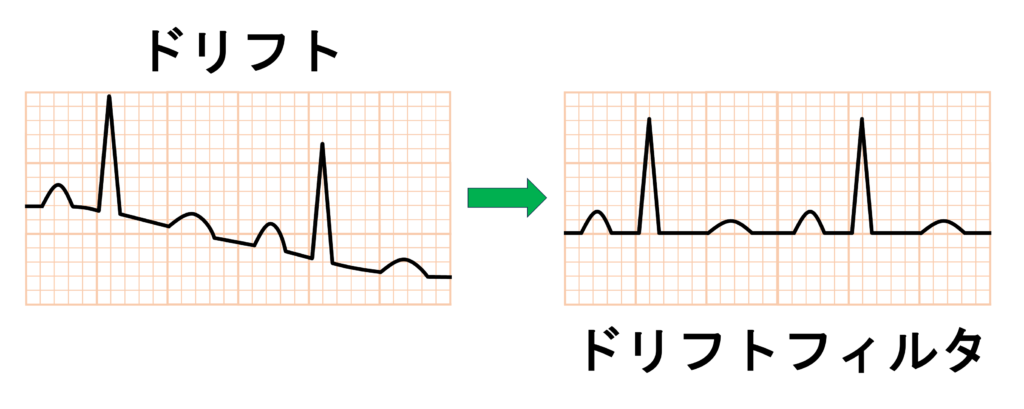 フィルタ(filter)