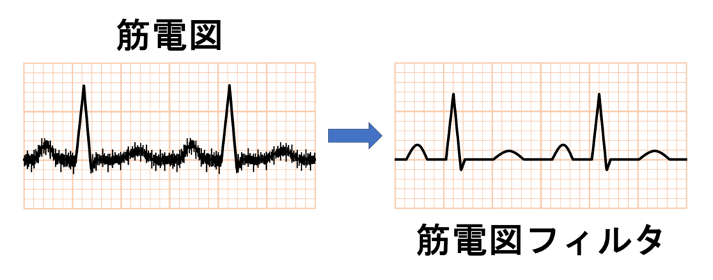 フィルタ(filter)