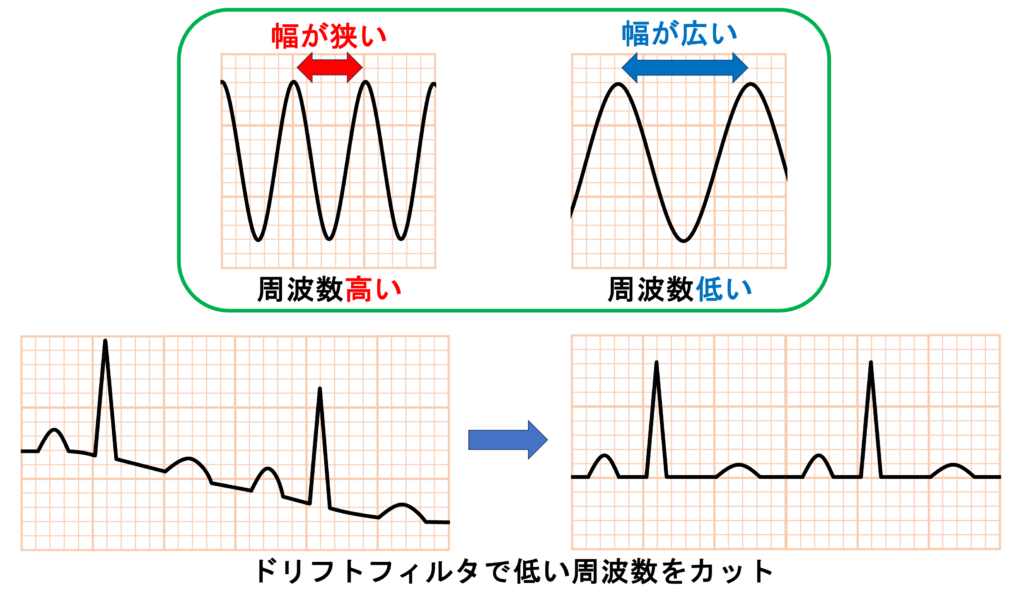 ドリフト(baseline drift, baseline wander)