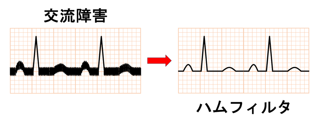 フィルタ(filter)