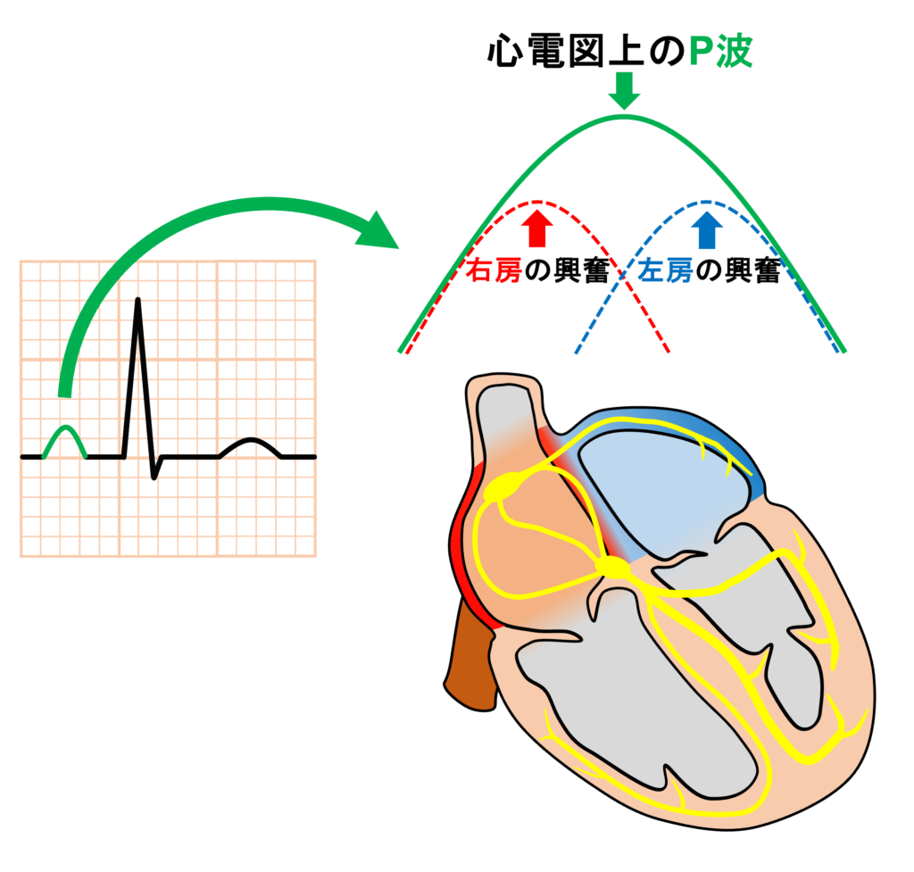 P波(P wave)