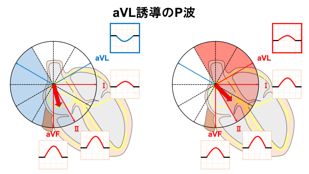 P波(P wave)