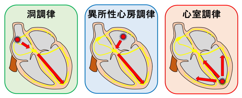 洞調律(sinus rhythm)
