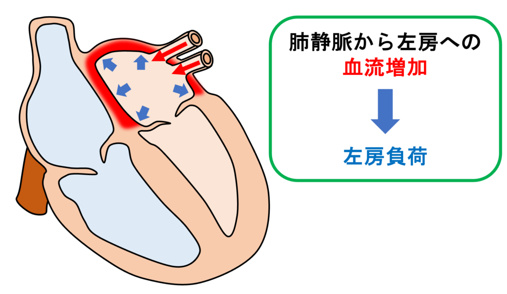 動脈管開存症(patent ductus ateriosus)
