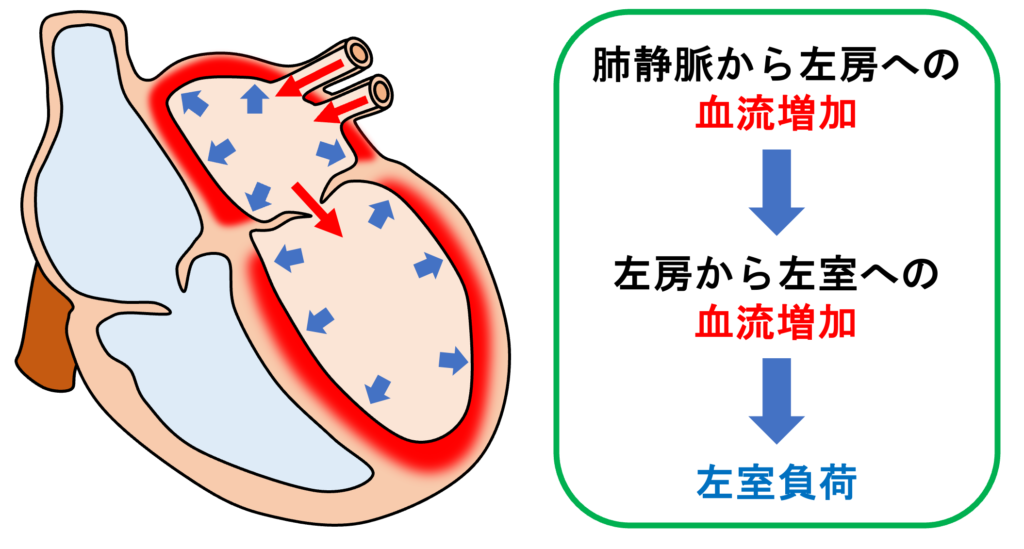 動脈管開存症(patent ductus ateriosus)